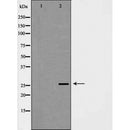 DF7283 at 1/100 staining Human uterus tissue by IHC-P. The sample was formaldehyde fixed and a heat mediated antigen retrieval step in citrate buffer was performed. The sample was then blocked and incubated with the antibody for 1.5 hours at 22¡ãC. An HRP conjugated goat anti-rabbit antibody was used as the secondary