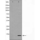 DF7285 at 1/100 staining Human uterus tissue by IHC-P. The sample was formaldehyde fixed and a heat mediated antigen retrieval step in citrate buffer was performed. The sample was then blocked and incubated with the antibody for 1.5 hours at 22¡ãC. An HRP conjugated goat anti-rabbit antibody was used as the secondary