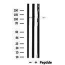 DF7286 at 1/100 staining Human prostate tissue by IHC-P. The sample was formaldehyde fixed and a heat mediated antigen retrieval step in citrate buffer was performed. The sample was then blocked and incubated with the antibody for 1.5 hours at 22¡ãC. An HRP conjugated goat anti-rabbit antibody was used as the secondary