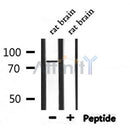 DF7288 at 1/100 staining Human gastric tissue by IHC-P. The sample was formaldehyde fixed and a heat mediated antigen retrieval step in citrate buffer was performed. The sample was then blocked and incubated with the antibody for 1.5 hours at 22¡ãC. An HRP conjugated goat anti-rabbit antibody was used as the secondary