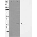 DF7289 at 1/100 staining Mouse liver tissue by IHC-P. The sample was formaldehyde fixed and a heat mediated antigen retrieval step in citrate buffer was performed. The sample was then blocked and incubated with the antibody for 1.5 hours at 22¡ãC. An HRP conjugated goat anti-rabbit antibody was used as the secondary