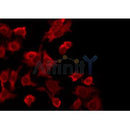 Western blot analysis of extracts from Mouse cancer, using LTBR Antibody. Lane 1 was treated with the blocking peptide.