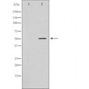 DF7296 at 1/100 staining Human breast cancer tissue by IHC-P. The sample was formaldehyde fixed and a heat mediated antigen retrieval step in citrate buffer was performed. The sample was then blocked and incubated with the antibody for 1.5 hours at 22¡ãC. An HRP conjugated goat anti-rabbit antibody was used as the secondary