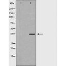 DF7297 at 1/100 staining Mouse spleen tissue by IHC-P. The sample was formaldehyde fixed and a heat mediated antigen retrieval step in citrate buffer was performed. The sample was then blocked and incubated with the antibody for 1.5 hours at 22¡ãC. An HRP conjugated goat anti-rabbit antibody was used as the secondary