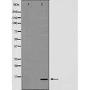 DF7302 at 1/100 staining Mouse heart tissue by IHC-P. The sample was formaldehyde fixed and a heat mediated antigen retrieval step in citrate buffer was performed. The sample was then blocked and incubated with the antibody for 1.5 hours at 22¡ãC. An HRP conjugated goat anti-rabbit antibody was used as the secondary