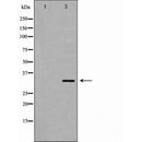 DF7304 at 1/100 staining Human melanoma tissue by IHC-P. The sample was formaldehyde fixed and a heat mediated antigen retrieval step in citrate buffer was performed. The sample was then blocked and incubated with the antibody for 1.5 hours at 22¡ãC. An HRP conjugated goat anti-rabbit antibody was used as the secondary