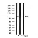 DF7305 at 1/100 staining Human liver cancer tissue by IHC-P. The sample was formaldehyde fixed and a heat mediated antigen retrieval step in citrate buffer was performed. The sample was then blocked and incubated with the antibody for 1.5 hours at 22¡ãC. An HRP conjugated goat anti-rabbit antibody was used as the secondary