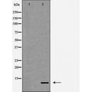 DF7307 at 1/100 staining Mouse liver tissue by IHC-P. The sample was formaldehyde fixed and a heat mediated antigen retrieval step in citrate buffer was performed. The sample was then blocked and incubated with the antibody for 1.5 hours at 22¡ãC. An HRP conjugated goat anti-rabbit antibody was used as the secondary