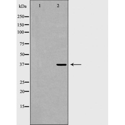 DF7325 at 1/100 staining Mouse heart tissue by IHC-P. The sample was formaldehyde fixed and a heat mediated antigen retrieval step in citrate buffer was performed. The sample was then blocked and incubated with the antibody for 1.5 hours at 22¡ãC. An HRP conjugated goat anti-rabbit antibody was used as the secondary