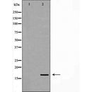 DF7331 at 1/100 staining Human lymph node tissue by IHC-P. The sample was formaldehyde fixed and a heat mediated antigen retrieval step in citrate buffer was performed. The sample was then blocked and incubated with the antibody for 1.5 hours at 22¡ãC. An HRP conjugated goat anti-rabbit antibody was used as the secondary