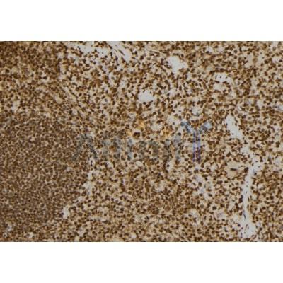 Western blot analysis of extracts from 293t, using PRKRA Antibody. The lane on the left was treated with blocking peptide.