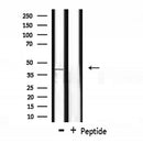 DF7338 at 1/100 staining Mouse testis tissue by IHC-P. The sample was formaldehyde fixed and a heat mediated antigen retrieval step in citrate buffer was performed. The sample was then blocked and incubated with the antibody for 1.5 hours at 22¡ãC. An HRP conjugated goat anti-rabbit antibody was used as the secondary