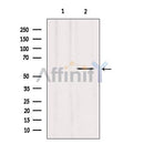 Western blot analysis of extracts from B16F10, using RIPK3 Antibody. The lane on the left was treated with blocking peptide.