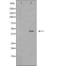 DF7341 at 1/100 staining Mouse testis tissue by IHC-P. The sample was formaldehyde fixed and a heat mediated antigen retrieval step in citrate buffer was performed. The sample was then blocked and incubated with the antibody for 1.5 hours at 22¡ãC. An HRP conjugated goat anti-rabbit antibody was used as the secondary