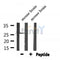 DF7342 at 1/100 staining Rat liver tissue by IHC-P. The sample was formaldehyde fixed and a heat mediated antigen retrieval step in citrate buffer was performed. The sample was then blocked and incubated with the antibody for 1.5 hours at 22¡ãC. An HRP conjugated goat anti-rabbit antibody was used as the secondary