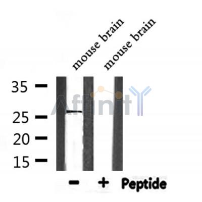 DF7342 at 1/100 staining Rat liver tissue by IHC-P. The sample was formaldehyde fixed and a heat mediated antigen retrieval step in citrate buffer was performed. The sample was then blocked and incubated with the antibody for 1.5 hours at 22¡ãC. An HRP conjugated goat anti-rabbit antibody was used as the secondary