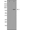 DF7348 at 1/100 staining Mouse colon tissue by IHC-P. The sample was formaldehyde fixed and a heat mediated antigen retrieval step in citrate buffer was performed. The sample was then blocked and incubated with the antibody for 1.5 hours at 22¡ãC. An HRP conjugated goat anti-rabbit antibody was used as the secondary
