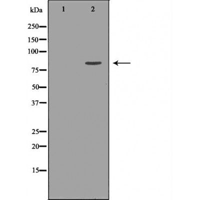 DF7348 at 1/100 staining Mouse colon tissue by IHC-P. The sample was formaldehyde fixed and a heat mediated antigen retrieval step in citrate buffer was performed. The sample was then blocked and incubated with the antibody for 1.5 hours at 22¡ãC. An HRP conjugated goat anti-rabbit antibody was used as the secondary