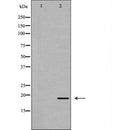 DF7350 at 1/100 staining Human liver tissue by IHC-P. The sample was formaldehyde fixed and a heat mediated antigen retrieval step in citrate buffer was performed. The sample was then blocked and incubated with the antibody for 1.5 hours at 22¡ãC. An HRP conjugated goat anti-rabbit antibody was used as the secondary