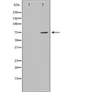DF7353 at 1/100 staining Human prostate tissue by IHC-P. The sample was formaldehyde fixed and a heat mediated antigen retrieval step in citrate buffer was performed. The sample was then blocked and incubated with the antibody for 1.5 hours at 22¡ãC. An HRP conjugated goat anti-rabbit antibody was used as the secondary