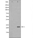 DF7359 at 1/100 staining Human gastric tissue by IHC-P. The sample was formaldehyde fixed and a heat mediated antigen retrieval step in citrate buffer was performed. The sample was then blocked and incubated with the antibody for 1.5 hours at 22¡ãC. An HRP conjugated goat anti-rabbit antibody was used as the secondary