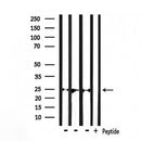 DF7363 at 1/100 staining Mouse liver tissue by IHC-P. The sample was formaldehyde fixed and a heat mediated antigen retrieval step in citrate buffer was performed. The sample was then blocked and incubated with the antibody for 1.5 hours at 22¡ãC. An HRP conjugated goat anti-rabbit antibody was used as the secondary