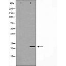 DF7365 at 1/100 staining Mouse liver tissue by IHC-P. The sample was formaldehyde fixed and a heat mediated antigen retrieval step in citrate buffer was performed. The sample was then blocked and incubated with the antibody for 1.5 hours at 22¡ãC. An HRP conjugated goat anti-rabbit antibody was used as the secondary