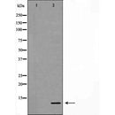 DF7368 at 1/100 staining Mouse spleen tissue by IHC-P. The sample was formaldehyde fixed and a heat mediated antigen retrieval step in citrate buffer was performed. The sample was then blocked and incubated with the antibody for 1.5 hours at 22¡ãC. An HRP conjugated goat anti-rabbit antibody was used as the secondary