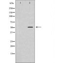 DF7369 at 1/100 staining Human Melanoma tissue by IHC-P. The sample was formaldehyde fixed and a heat mediated antigen retrieval step in citrate buffer was performed. The sample was then blocked and incubated with the antibody for 1.5 hours at 22¡ãC. An HRP conjugated goat anti-rabbit antibody was used as the secondary