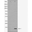 DF7370 at 1/100 staining Human gastric tissue by IHC-P. The sample was formaldehyde fixed and a heat mediated antigen retrieval step in citrate buffer was performed. The sample was then blocked and incubated with the antibody for 1.5 hours at 22¡ãC. An HRP conjugated goat anti-rabbit antibody was used as the secondary