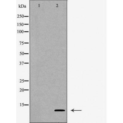 DF7370 at 1/100 staining Human gastric tissue by IHC-P. The sample was formaldehyde fixed and a heat mediated antigen retrieval step in citrate buffer was performed. The sample was then blocked and incubated with the antibody for 1.5 hours at 22¡ãC. An HRP conjugated goat anti-rabbit antibody was used as the secondary