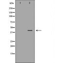 DF7374 at 1/100 staining Human gastric tissue by IHC-P. The sample was formaldehyde fixed and a heat mediated antigen retrieval step in citrate buffer was performed. The sample was then blocked and incubated with the antibody for 1.5 hours at 22¡ãC. An HRP conjugated goat anti-rabbit antibody was used as the secondary