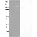 DF7376 at 1/100 staining Mouse muscle tissue by IHC-P. The sample was formaldehyde fixed and a heat mediated antigen retrieval step in citrate buffer was performed. The sample was then blocked and incubated with the antibody for 1.5 hours at 22¡ãC. An HRP conjugated goat anti-rabbit antibody was used as the secondary