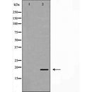 DF7378 at 1/100 staining Human kidney tissue by IHC-P. The sample was formaldehyde fixed and a heat mediated antigen retrieval step in citrate buffer was performed. The sample was then blocked and incubated with the antibody for 1.5 hours at 22¡ãC. An HRP conjugated goat anti-rabbit antibody was used as the secondary