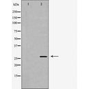 DF7384 at 1/100 staining Mouse testis tissue by IHC-P. The sample was formaldehyde fixed and a heat mediated antigen retrieval step in citrate buffer was performed. The sample was then blocked and incubated with the antibody for 1.5 hours at 22¡ãC. An HRP conjugated goat anti-rabbit antibody was used as the secondary