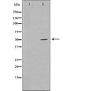 DF7389 at 1/100 staining Mouse muscle tissue by IHC-P. The sample was formaldehyde fixed and a heat mediated antigen retrieval step in citrate buffer was performed. The sample was then blocked and incubated with the antibody for 1.5 hours at 22¡ãC. An HRP conjugated goat anti-rabbit antibody was used as the secondary