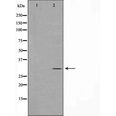 DF7393 at 1/100 staining Human prostate tissue by IHC-P. The sample was formaldehyde fixed and a heat mediated antigen retrieval step in citrate buffer was performed. The sample was then blocked and incubated with the antibody for 1.5 hours at 22¡ãC. An HRP conjugated goat anti-rabbit antibody was used as the secondary