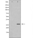 DF7402 at 1/100 staining Rat heart tissue by IHC-P. The sample was formaldehyde fixed and a heat mediated antigen retrieval step in citrate buffer was performed. The sample was then blocked and incubated with the antibody for 1.5 hours at 22¡ãC. An HRP conjugated goat anti-rabbit antibody was used as the secondary