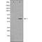 DF7405 at 1/100 staining Human liver cancer tissue by IHC-P. The sample was formaldehyde fixed and a heat mediated antigen retrieval step in citrate buffer was performed. The sample was then blocked and incubated with the antibody for 1.5 hours at 22¡ãC. An HRP conjugated goat anti-rabbit antibody was used as the secondary
