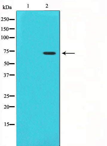 Western blot analysis on HuvEc cell lysate using Cox1 Antibody,The lane on the left is treated with the antigen-specific peptide.