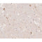 AF0138 at 1/200 staining human brain tissue sections by IHC-P. The tissue was formaldehyde fixed and a heat mediated antigen retrieval step in citrate buffer was performed. The tissue was then blocked and incubated with the antibody for 1.5 hours at 22¡ãC. An HRP conjugated goat anti-rabbit antibody was used as the secondary