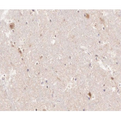 AF0138 at 1/200 staining human brain tissue sections by IHC-P. The tissue was formaldehyde fixed and a heat mediated antigen retrieval step in citrate buffer was performed. The tissue was then blocked and incubated with the antibody for 1.5 hours at 22¡ãC. An HRP conjugated goat anti-rabbit antibody was used as the secondary