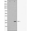 DF7406 at 1/100 staining Rat kidney tissue by IHC-P. The sample was formaldehyde fixed and a heat mediated antigen retrieval step in citrate buffer was performed. The sample was then blocked and incubated with the antibody for 1.5 hours at 22¡ãC. An HRP conjugated goat anti-rabbit antibody was used as the secondary