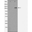 DF7409 at 1/100 staining Rat spleen tissue by IHC-P. The sample was formaldehyde fixed and a heat mediated antigen retrieval step in citrate buffer was performed. The sample was then blocked and incubated with the antibody for 1.5 hours at 22¡ãC. An HRP conjugated goat anti-rabbit antibody was used as the secondary