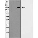 DF7410 at 1/100 staining Mouse muscle tissue by IHC-P. The sample was formaldehyde fixed and a heat mediated antigen retrieval step in citrate buffer was performed. The sample was then blocked and incubated with the antibody for 1.5 hours at 22¡ãC. An HRP conjugated goat anti-rabbit antibody was used as the secondary