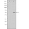 DF7415 at 1/100 staining Human melanoma tissue by IHC-P. The sample was formaldehyde fixed and a heat mediated antigen retrieval step in citrate buffer was performed. The sample was then blocked and incubated with the antibody for 1.5 hours at 22¡ãC. An HRP conjugated goat anti-rabbit antibody was used as the secondary