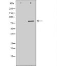 DF7418 at 1/100 staining Mouse kidney tissue by IHC-P. The sample was formaldehyde fixed and a heat mediated antigen retrieval step in citrate buffer was performed. The sample was then blocked and incubated with the antibody for 1.5 hours at 22¡ãC. An HRP conjugated goat anti-rabbit antibody was used as the secondary