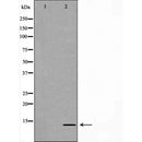 DF7419 at 1/100 staining Mouse kidney tissue by IHC-P. The sample was formaldehyde fixed and a heat mediated antigen retrieval step in citrate buffer was performed. The sample was then blocked and incubated with the antibody for 1.5 hours at 22¡ãC. An HRP conjugated goat anti-rabbit antibody was used as the secondary