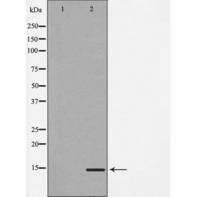 DF7421 staining U87 by IF/ICC. The sample were fixed with PFA and permeabilized in 0.1% Triton X-100,then blocked in 10% serum for 45 minutes at 25¡ãC. The primary antibody was diluted at 1/200 and incubated with the sample for 1 hour at 37¡ãC. An  Alexa Fluor 594 conjugated goat anti-rabbit IgG (H+L) Ab, diluted at 1/600, was used as the secondary antibod