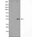 DF7423 staining HepG2 by IF/ICC. The sample were fixed with PFA and permeabilized in 0.1% Triton X-100,then blocked in 10% serum for 45 minutes at 25¡ãC. The primary antibody was diluted at 1/200 and incubated with the sample for 1 hour at 37¡ãC. An  Alexa Fluor 594 conjugated goat anti-rabbit IgG (H+L) Ab, diluted at 1/600, was used as the secondary antibod